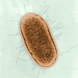 Escherichia coli (кишечная палочка)
